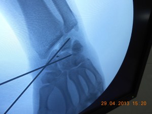 DSCN0972